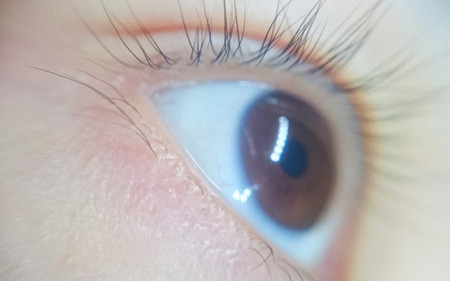 目を覆いたくなるほど怖いのに 目が閉じられない白内障の手術 Radichubu ラジチューブ 目を覆いたくなるほど怖いのに 目が閉じられない白内障の手術 Radichubu ラジチューブ